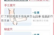 打了新冠疫苗手背发麻怎么回事 疫苗副作用手麻