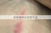 疫苗接种后颈部不适