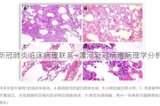 新冠肺炎临床病理联系—漯河新冠病毒病理学分析