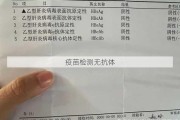 疫苗检测无抗体