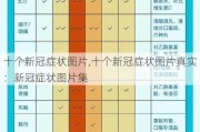 十个新冠症状图片,十个新冠症状图片真实：新冠症状图片集