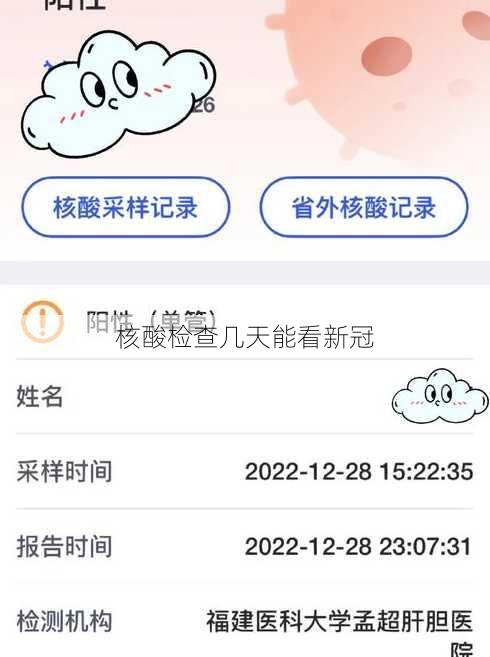 核酸检查几天能看新冠