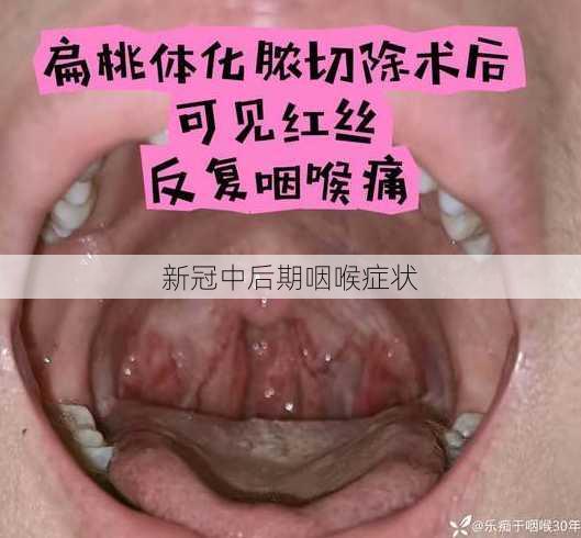 新冠中后期咽喉症状