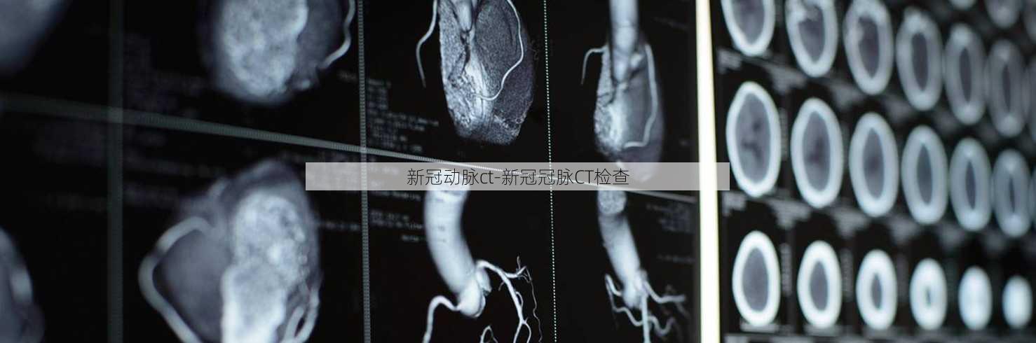 新冠动脉ct-新冠冠脉CT检查