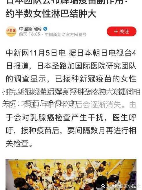 打完新冠疫苗后浑身浮肿怎么办-关键词相关词：疫苗后全身水肿