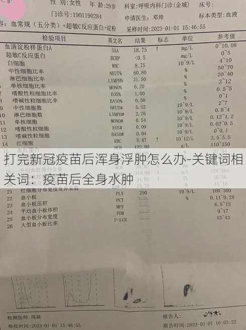 打完新冠疫苗后浑身浮肿怎么办-关键词相关词：疫苗后全身水肿