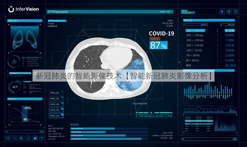 新冠肺炎的智能影像技术【智能新冠肺炎影像分析】