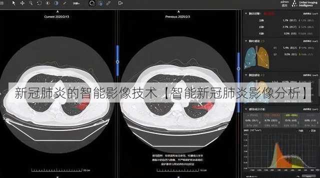 新冠肺炎的智能影像技术【智能新冠肺炎影像分析】