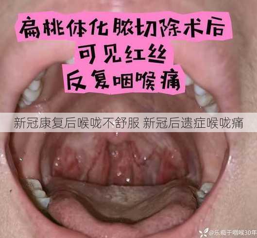 新冠康复后喉咙不舒服 新冠后遗症喉咙痛