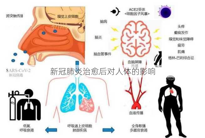 新冠肺炎治愈后对人体的影响