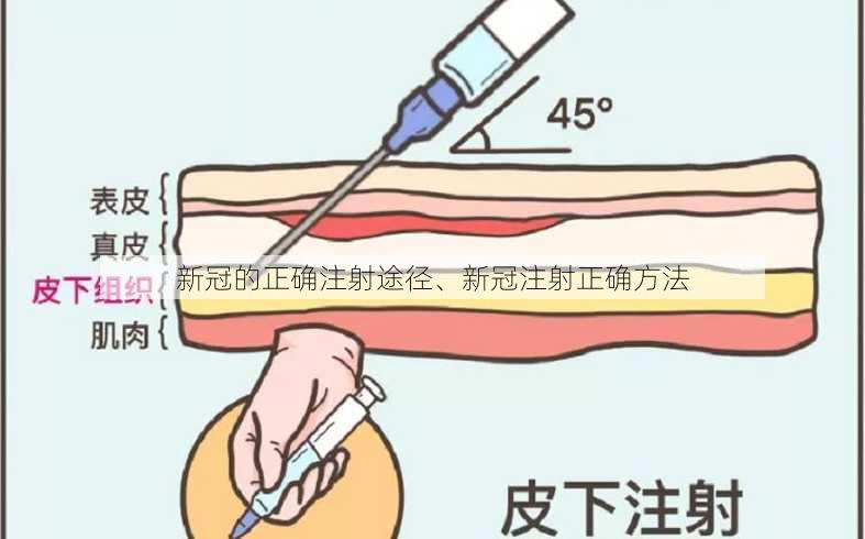 新冠的正确注射途径、新冠注射正确方法