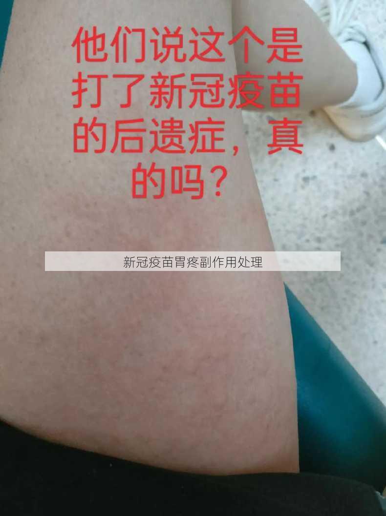 新冠疫苗胃疼副作用处理