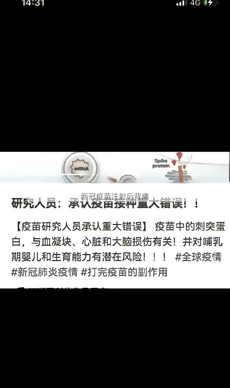 新冠疫苗注射后背痛