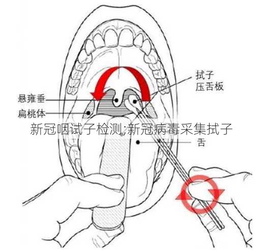 新冠咽试子检测;新冠病毒采集拭子