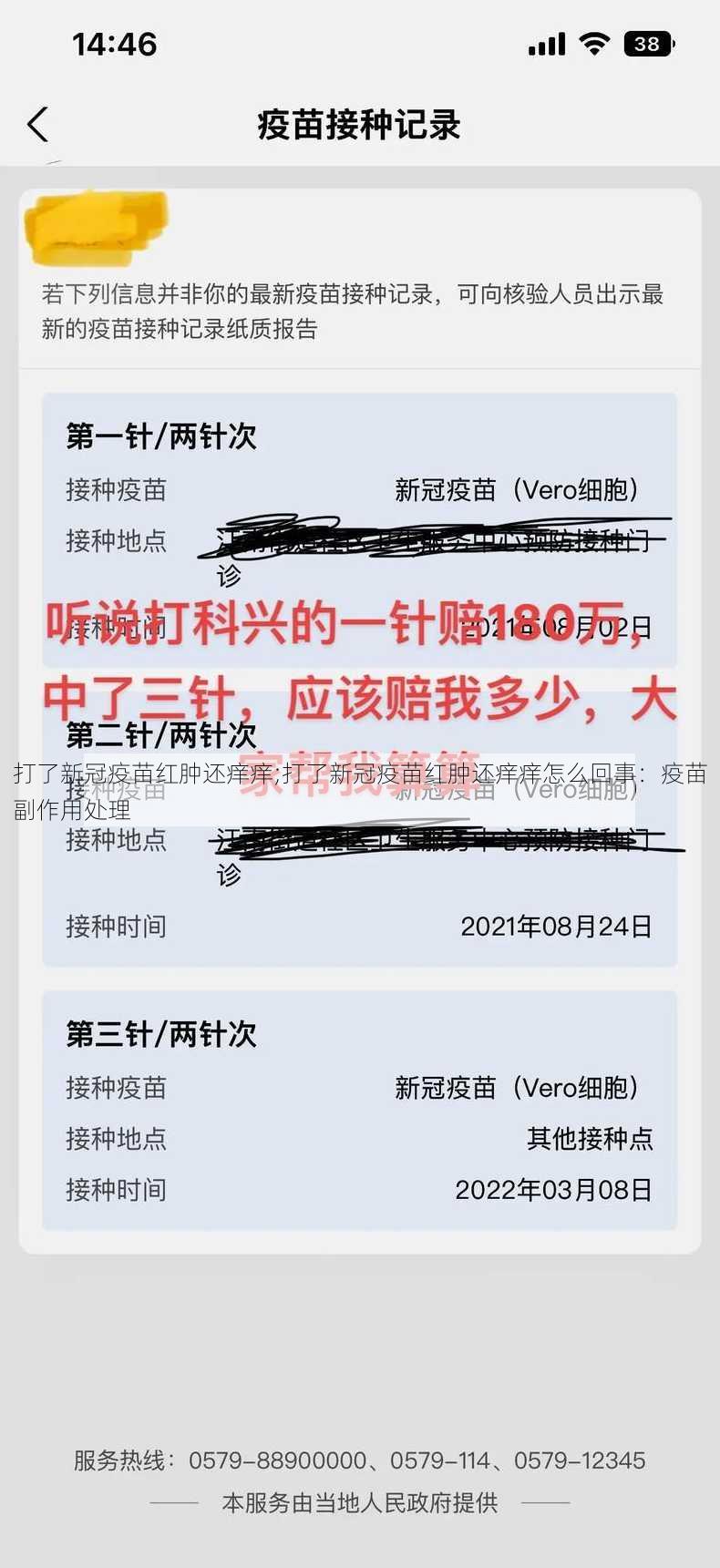 打了新冠疫苗红肿还痒痒;打了新冠疫苗红肿还痒痒怎么回事：疫苗副作用处理