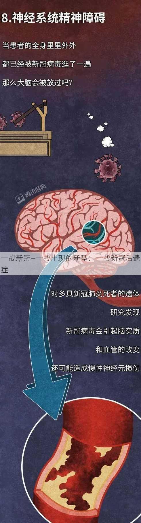 一战新冠—一战出现的新型：一战新冠后遗症