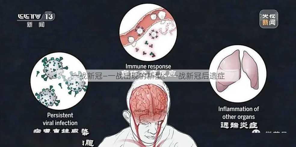 一战新冠—一战出现的新型：一战新冠后遗症