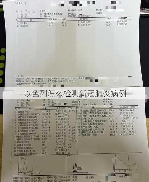 以色列怎么检测新冠肺炎病例