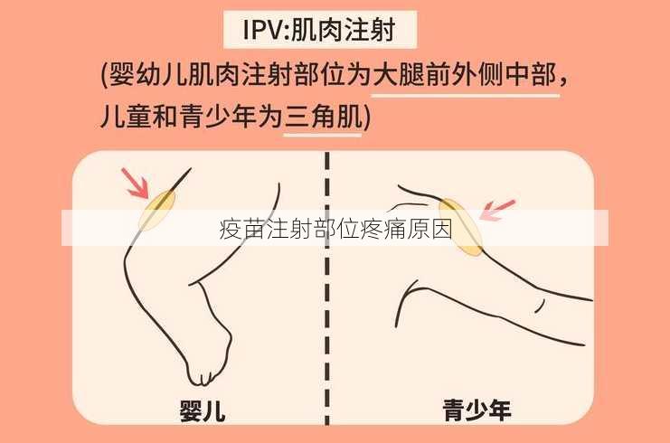 疫苗注射部位疼痛原因