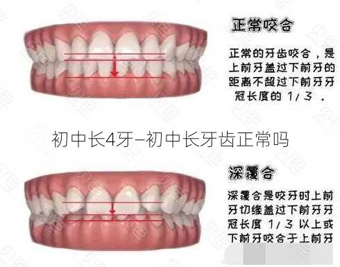 初中长4牙—初中长牙齿正常吗